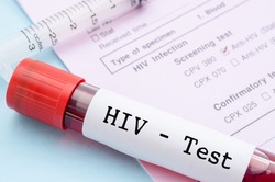 Специалисты территориального отдела Управления Роспотребнадзора напомнили губкинцам о ВИЧ