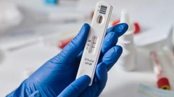 15 человек заболели COVID-19 в Губкинском горокруге по состоянию на 21 октября