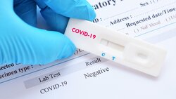 В Белгородской области начнётся тестирование на антитела к COVID-19