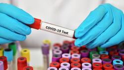 44 человека заболели COVID-19 в Губкинском горокруге по состоянию на 17 февраля