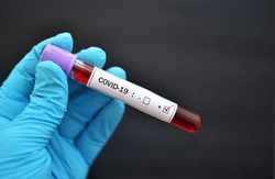 13 человек заболели COVID-19 в Губкинском горокруге по состоянию на 31 октября