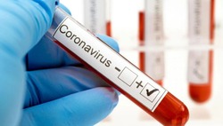 37 человек заболели COVID-19 в Губкинском горокруге по состоянию на 30 сентября