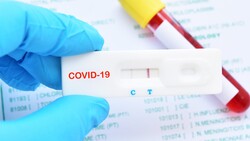 Тестирование на антитела к COVID-19, возможно, будет в Белгородской области