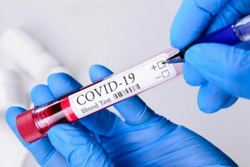 Медики выявили 101 новый случай COVID-19 в Белгородской области за сутки