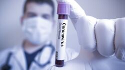 Белгородские медики обнаружили за сутки 57 новых заражений коронавирусом