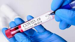 26 человек заболели COVID-19 в Губкинском горокруге по состоянию на 8 февраля