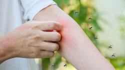 Врач аллерголог-иммунолог напомнила губкинцам об опасных укусах насекомых