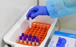Четыре человека заболели COVID-19 в Губкинском горокруге по состоянию на 18 августа