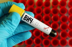 Губкинцы смогут обратиться на горячую линию по вопросам профилактики «ВИЧ-инфекции»