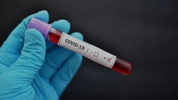 Медики выявили 107 новых случаев COVID-19 в Белгородской области за сутки