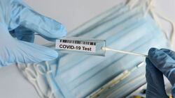 125 человек заболели COVID-19 в Губкинском горокруге по состоянию на 15 февраля