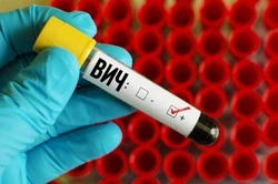 Губкинцы смогут обратиться на горячую линию по вопросам профилактики «ВИЧ-инфекции»